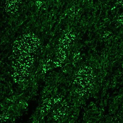 Immunohistochemistry (Formalin/PFA-fixed paraffin-embedded sections) - Anti-Neurofilament heavy polypeptide antibody [RNF404] (AB8972)