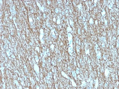 Immunohistochemistry (Formalin/PFA-fixed paraffin-embedded sections) - Anti-Neurofilament heavy polypeptide antibody [rNF421] (AB234296)