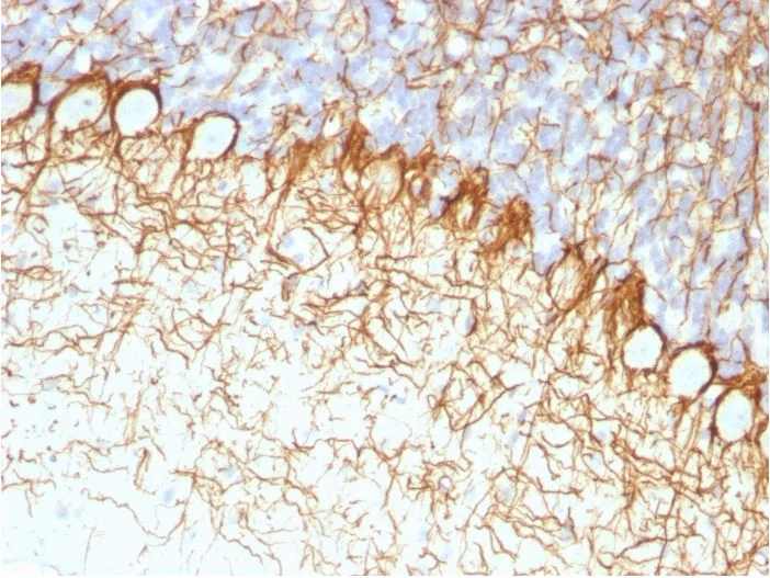 Immunohistochemistry (Formalin/PFA-fixed paraffin-embedded sections) - Anti-Neurofilament heavy polypeptide antibody [RT97] - BSA and Azide free (AB270560)