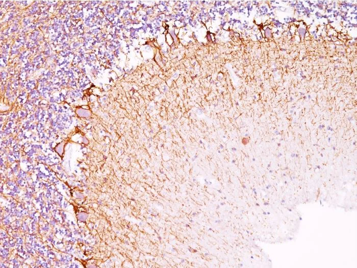 Immunohistochemistry (Formalin/PFA-fixed paraffin-embedded sections) - Anti-Neurofilament heavy polypeptide antibody [RT97] - BSA and Azide free (AB270560)