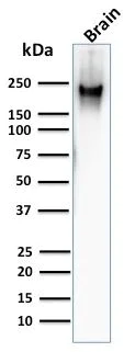 Western blot - Anti-Neurofilament heavy polypeptide antibody [RT97] - BSA and Azide free (AB270560)