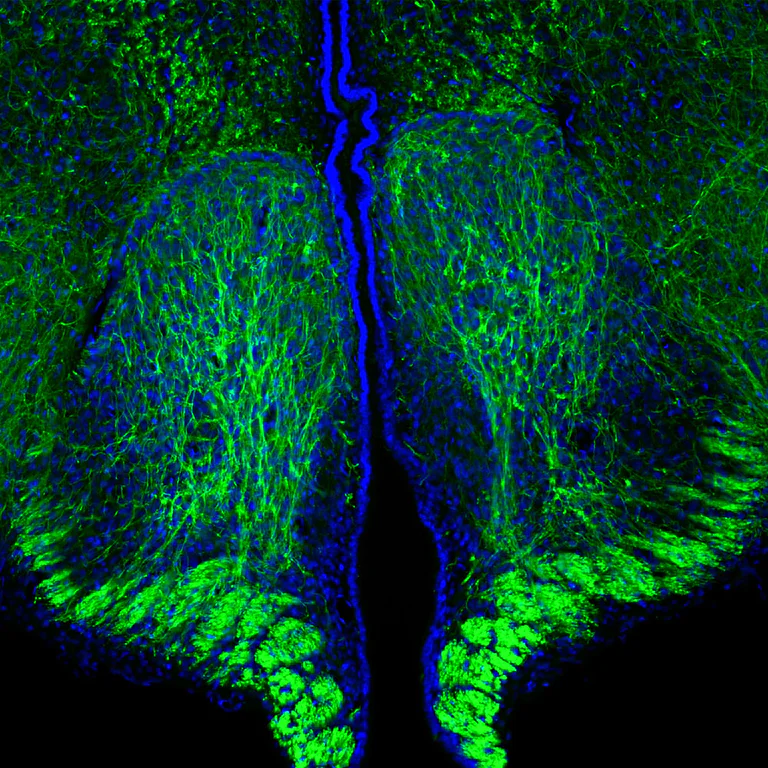 Immunohistochemistry (Formalin/PFA-fixed paraffin-embedded sections) - Anti-Neurofilament heavy polypeptide (phospho S) antibody [9B12] (AB315203)