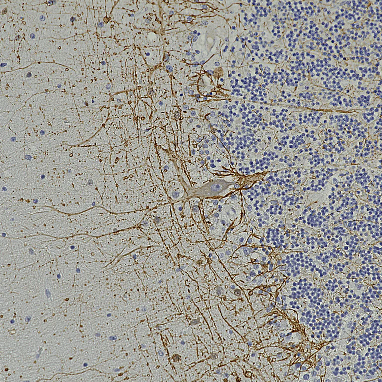 Immunohistochemistry (Formalin/PFA-fixed paraffin-embedded sections) - Anti-Neurofilament heavy polypeptide (phospho S) antibody [9B12] (AB315203)