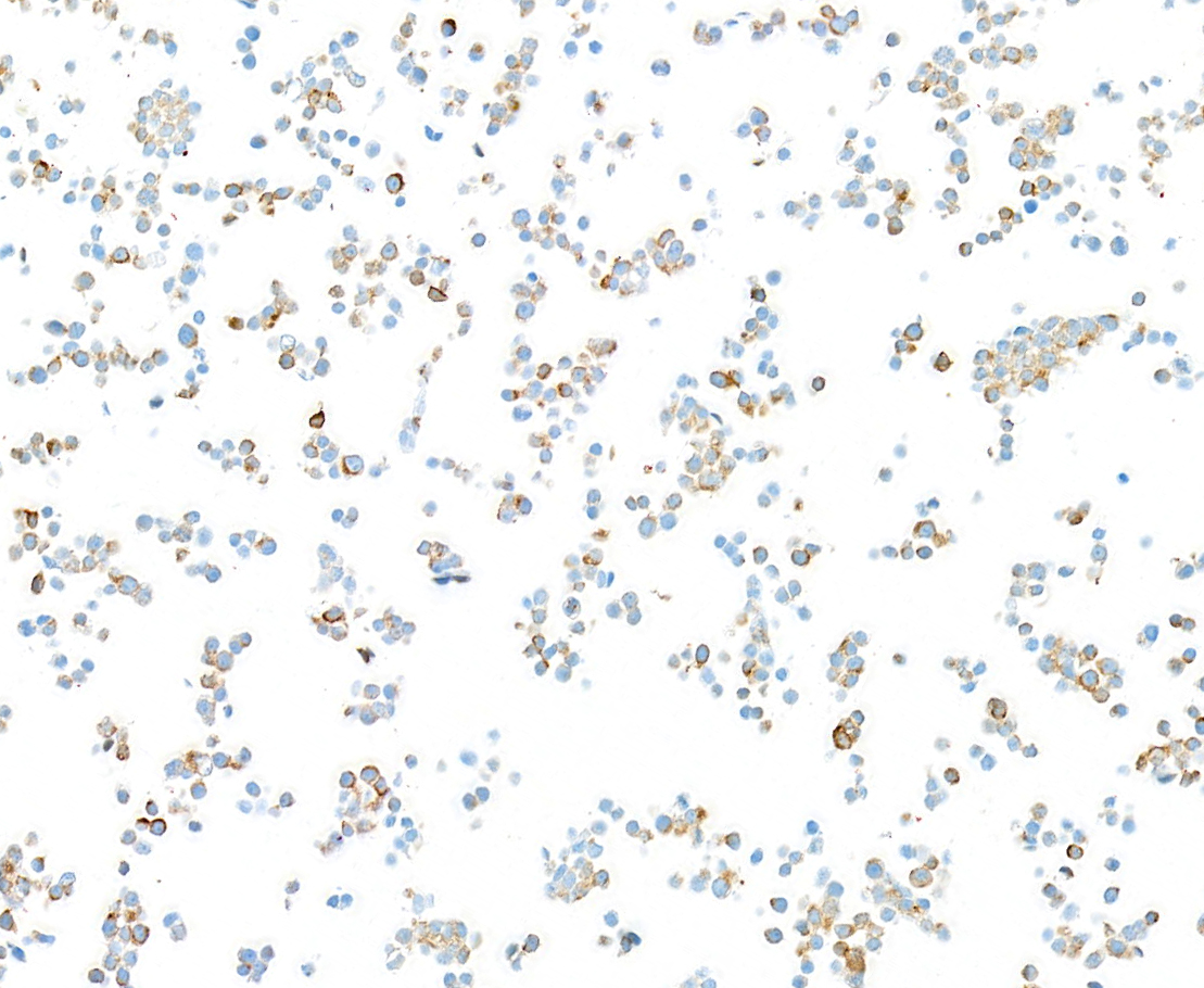 Immunocytochemistry - Anti-Neurofilament-L antibody [BLR224K] - BSA free (ab314079), expandable thumbnail