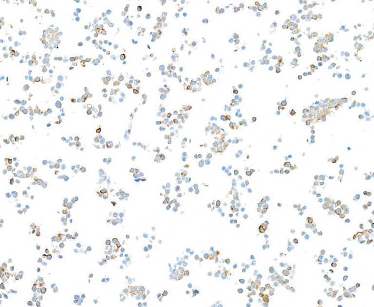 Immunocytochemistry - Anti-Neurofilament-L antibody [BLR224K] - BSA free (AB314079)