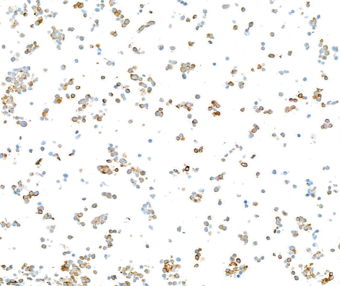 Immunocytochemistry - Anti-Neurofilament-L antibody [BLR224K] - BSA free (ab314079), expandable thumbnail