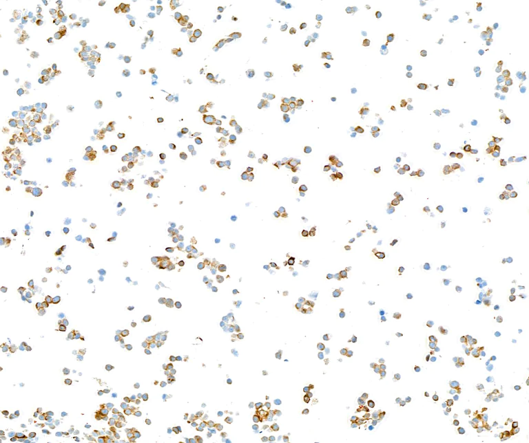 Immunocytochemistry - Anti-Neurofilament-L antibody [BLR224K] - BSA free (AB314079)