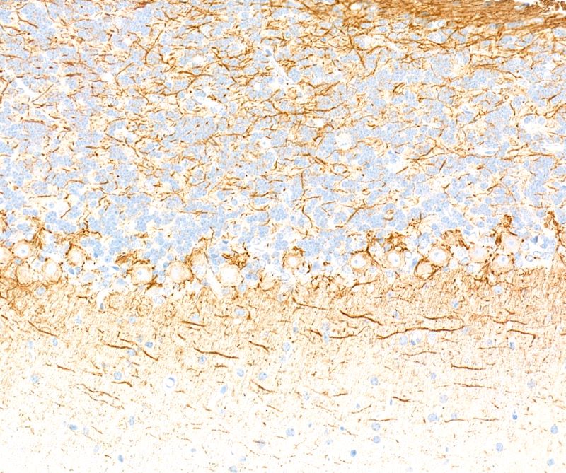 Immunohistochemistry (Formalin/PFA-fixed paraffin-embedded sections) - Anti-Neurofilament-L antibody [BLR224K] - BSA free (AB314079), expandable thumbnail