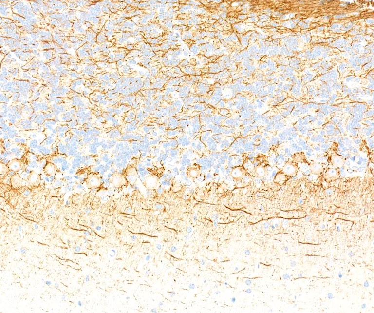 Immunohistochemistry (Formalin/PFA-fixed paraffin-embedded sections) - Anti-Neurofilament-L antibody [BLR224K] - BSA free (AB314079)