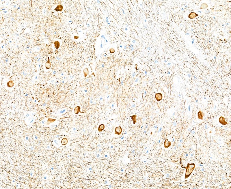 Immunohistochemistry (Formalin/PFA-fixed paraffin-embedded sections) - Anti-Neurofilament-L antibody [BLR224K] - BSA free (AB314079), expandable thumbnail