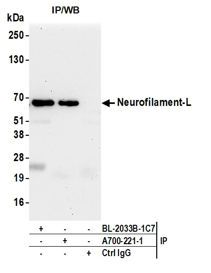 Immunoprecipitation - Anti-Neurofilament-L antibody [BLR224K] - BSA free (AB314079)