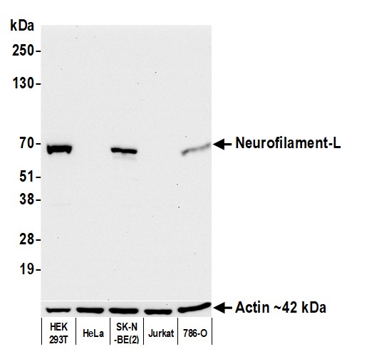 Western blot - Anti-Neurofilament-L antibody [BLR224K] - BSA free (AB314079), expandable thumbnail