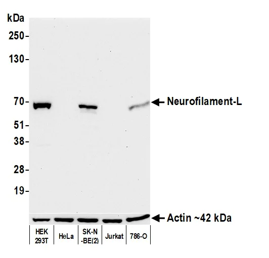 Western blot - Anti-Neurofilament-L antibody [BLR224K] - BSA free (AB314079)
