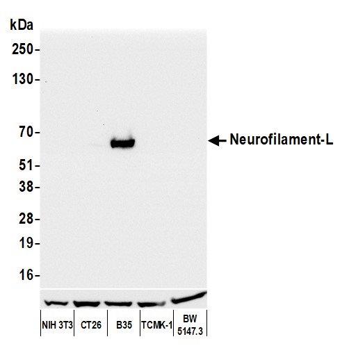 Western blot - Anti-Neurofilament-L antibody [BLR224K] - BSA free (AB314079), expandable thumbnail