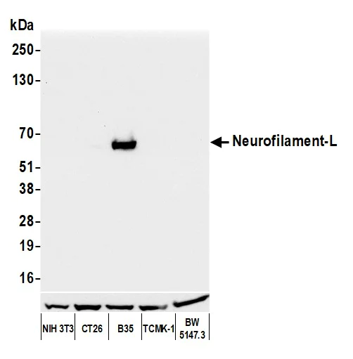 Western blot - Anti-Neurofilament-L antibody [BLR224K] - BSA free (AB314079)