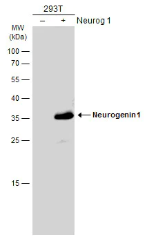 Western blot - Anti-Neurogenin 1/NEUROG1 antibody (AB272926)