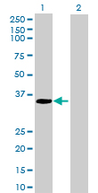 Western blot - Neurogenin 2 overexpression 293T lysate (whole cell) (AB94116)