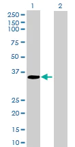 Western blot - Neurogenin 2 overexpression 293T lysate (whole cell) (AB94116)