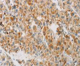 Immunohistochemistry (Formalin/PFA-fixed paraffin-embedded sections) - Anti-Neuroglobin antibody (AB197670)