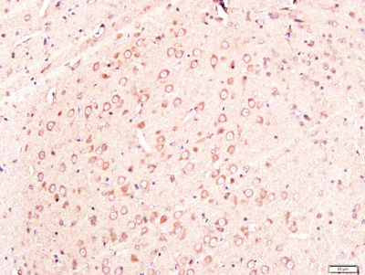 Immunohistochemistry (Formalin/PFA-fixed paraffin-embedded sections) - Anti-Neuroglycan C antibody (AB218137)