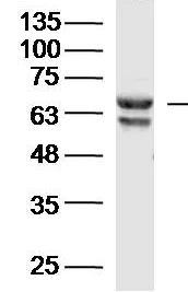 Western blot - Anti-Neuroglycan C antibody (AB218137)