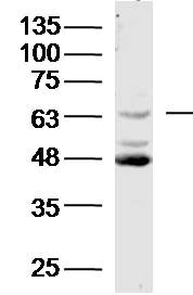 Western blot - Anti-Neuroglycan C antibody (AB218137)