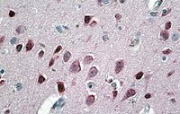 Immunohistochemistry (Formalin/PFA-fixed paraffin-embedded sections) - Anti-Neurogranin antibody (AB99269), expandable thumbnail