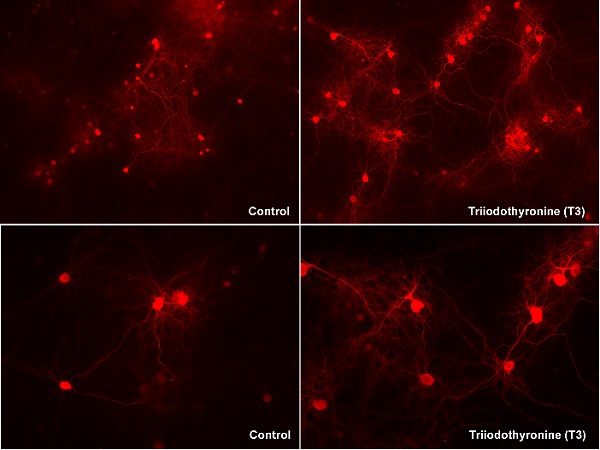 Immunocytochemistry/ Immunofluorescence - Anti-Neurogranin antibody [EPR21152] - BSA and Azide free (AB230154), expandable thumbnail