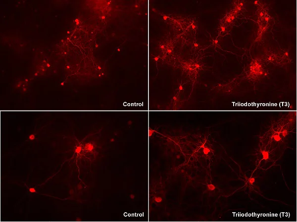 Immunocytochemistry/ Immunofluorescence - Anti-Neurogranin antibody [EPR21152] - BSA and Azide free (AB230154)