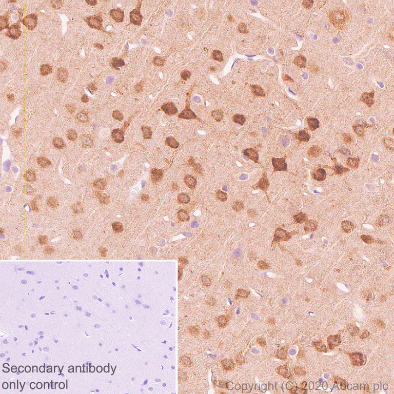 Immunohistochemistry (Formalin/PFA-fixed paraffin-embedded sections) - Anti-Neurogranin antibody [Ng2] (AB273443)