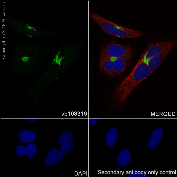 Immunocytochemistry/ Immunofluorescence - Neuroinflammation Marker (BDNF, ICAM1, TREM2, GFAP, TNF alpha, Iba1) Antibody Panel - Human (AB263462), expandable thumbnail