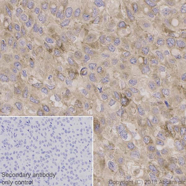 Immunohistochemistry (Formalin/PFA-fixed paraffin-embedded sections) - Neuroinflammation Marker (BDNF, ICAM1, TREM2, GFAP, TNF alpha, Iba1) Antibody Panel - Human (AB263462), expandable thumbnail