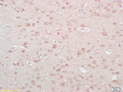 Immunohistochemistry (Formalin/PFA-fixed paraffin-embedded sections) - Anti-Neurokinin A antibody (AB216412)