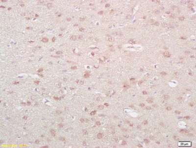 Immunohistochemistry (Formalin/PFA-fixed paraffin-embedded sections) - Anti-Neurokinin A antibody (AB216412)