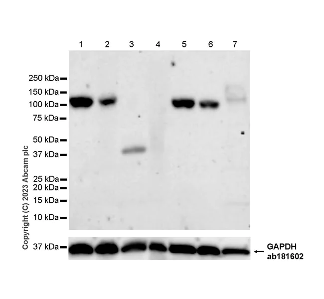 Western blot - Anti-Neuroligin 1 antibody [EPR27213-94] (AB308451)