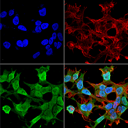Immunocytochemistry/ Immunofluorescence - Anti-Neuroligin 1 antibody [N97A/31] (AB186279), expandable thumbnail