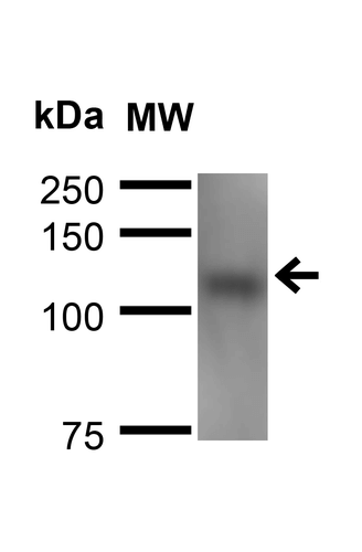 Western blot - Anti-Neuroligin 1 antibody [N97A/31] (AB186279), expandable thumbnail