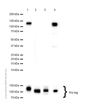 Western blot - Anti-Neuroligin 1 + Neuroligin 4 antibody [EPR13108] - BSA and Azide free (AB250464)