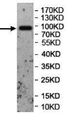 Western blot - Anti-Neuroligin 2 antibody (AB177107)
