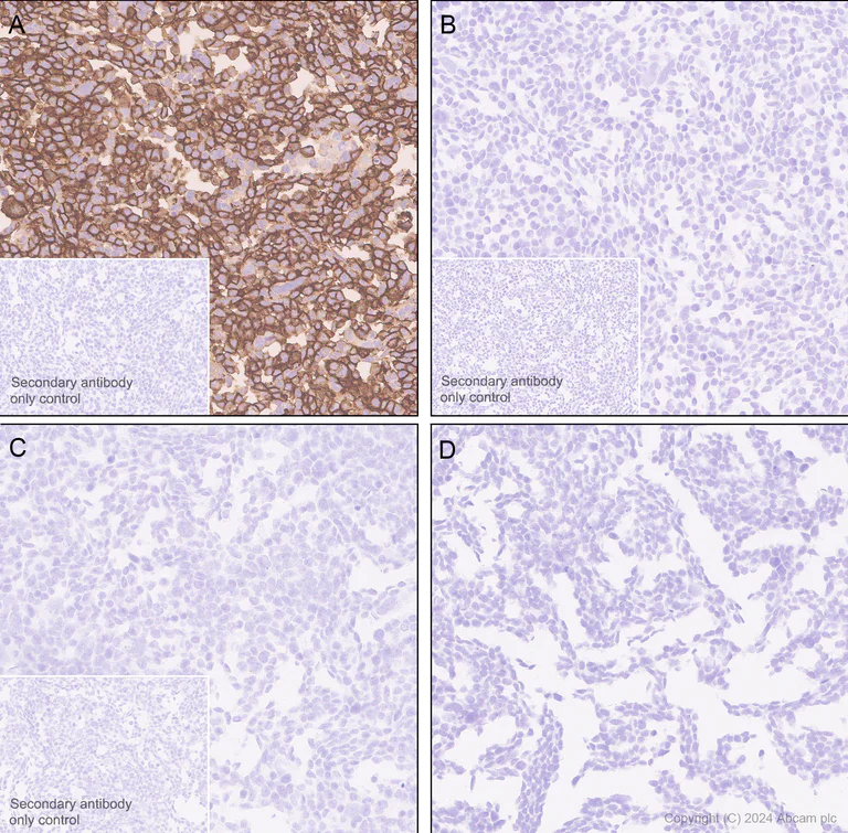 Immunohistochemistry (Formalin/PFA-fixed paraffin-embedded sections) - Anti-Neuroligin 2 antibody [EPR28230-122] (AB317303)