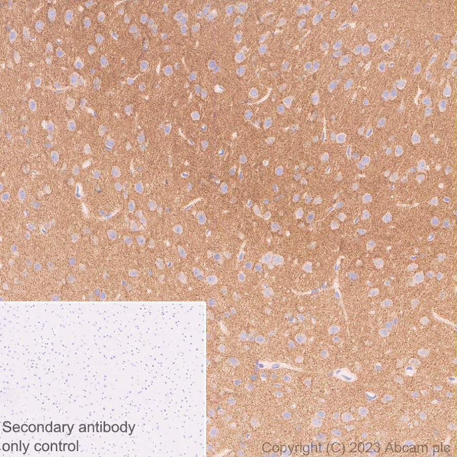 Immunohistochemistry (Formalin/PFA-fixed paraffin-embedded sections) - Anti-Neuroligin 2 antibody [EPR28230-17] (AB315094), expandable thumbnail