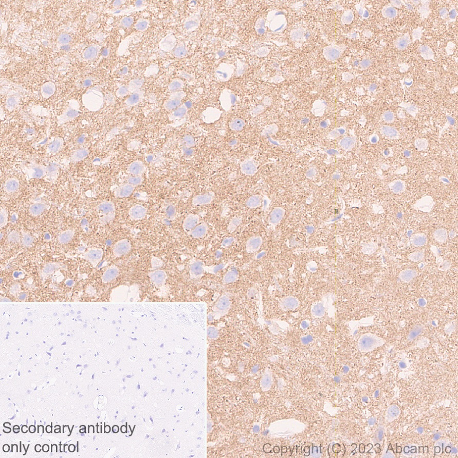 Immunohistochemistry (Formalin/PFA-fixed paraffin-embedded sections) - Anti-Neuroligin 2 antibody [EPR28230-17] (AB315094), expandable thumbnail