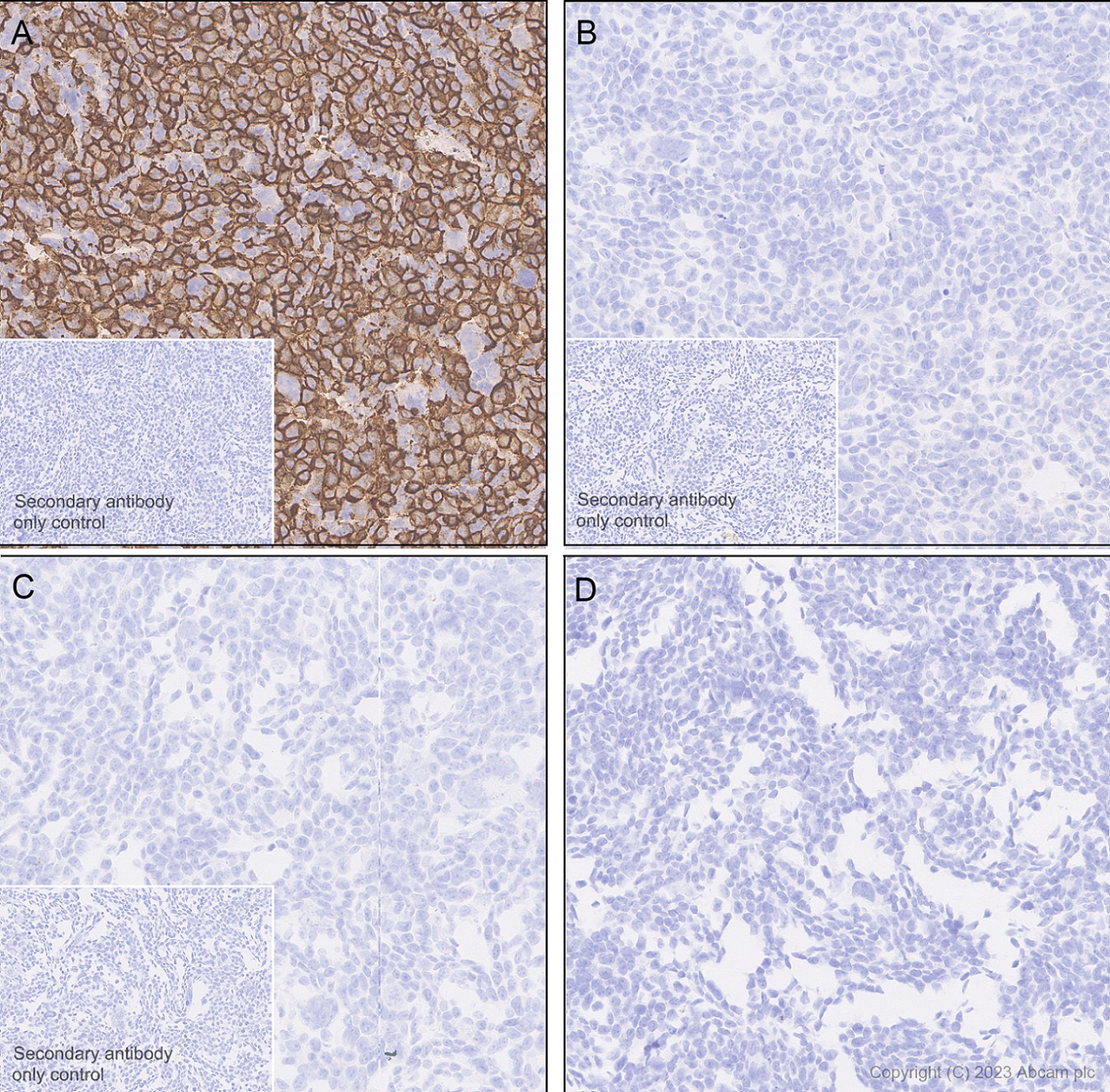 Immunohistochemistry (Formalin/PFA-fixed paraffin-embedded sections) - Anti-Neuroligin 2 antibody [EPR28230-17] (AB315094), expandable thumbnail
