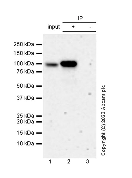 Immunoprecipitation - Anti-Neuroligin 2 antibody [EPR28230-17] (ab315094), expandable thumbnail