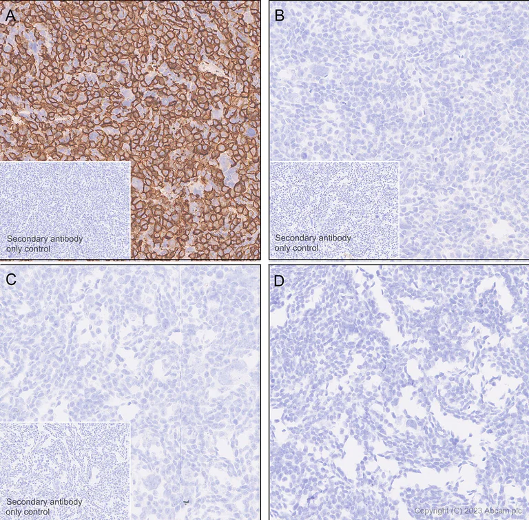 Immunohistochemistry (Formalin/PFA-fixed paraffin-embedded sections) - Anti-Neuroligin 2 antibody [EPR28230-17] - BSA and Azide free (AB315095)