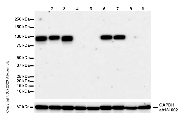 Western blot - Anti-Neuroligin 2 antibody [EPR28230-17] - BSA and Azide free (AB315095)