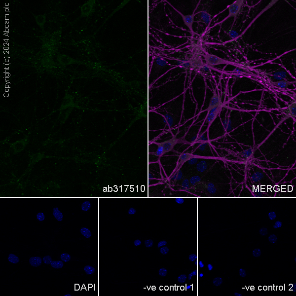 Immunocytochemistry/ Immunofluorescence - Anti-Neuroligin 2 antibody [RM2048] (AB317510), expandable thumbnail