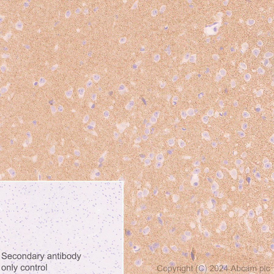 Immunohistochemistry (Formalin/PFA-fixed paraffin-embedded sections) - Anti-Neuroligin 2 antibody [RM2048] (ab317510), expandable thumbnail