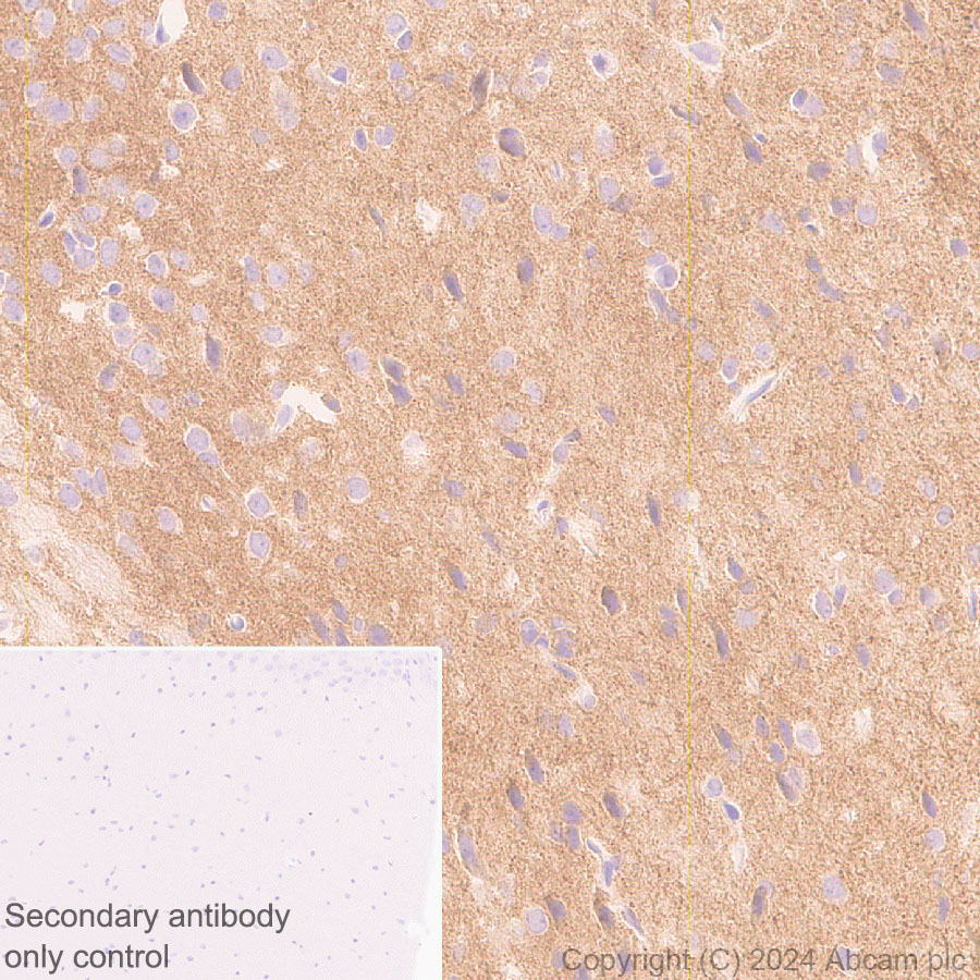 Immunohistochemistry (Formalin/PFA-fixed paraffin-embedded sections) - Anti-Neuroligin 2 antibody [RM2048] (ab317510), expandable thumbnail