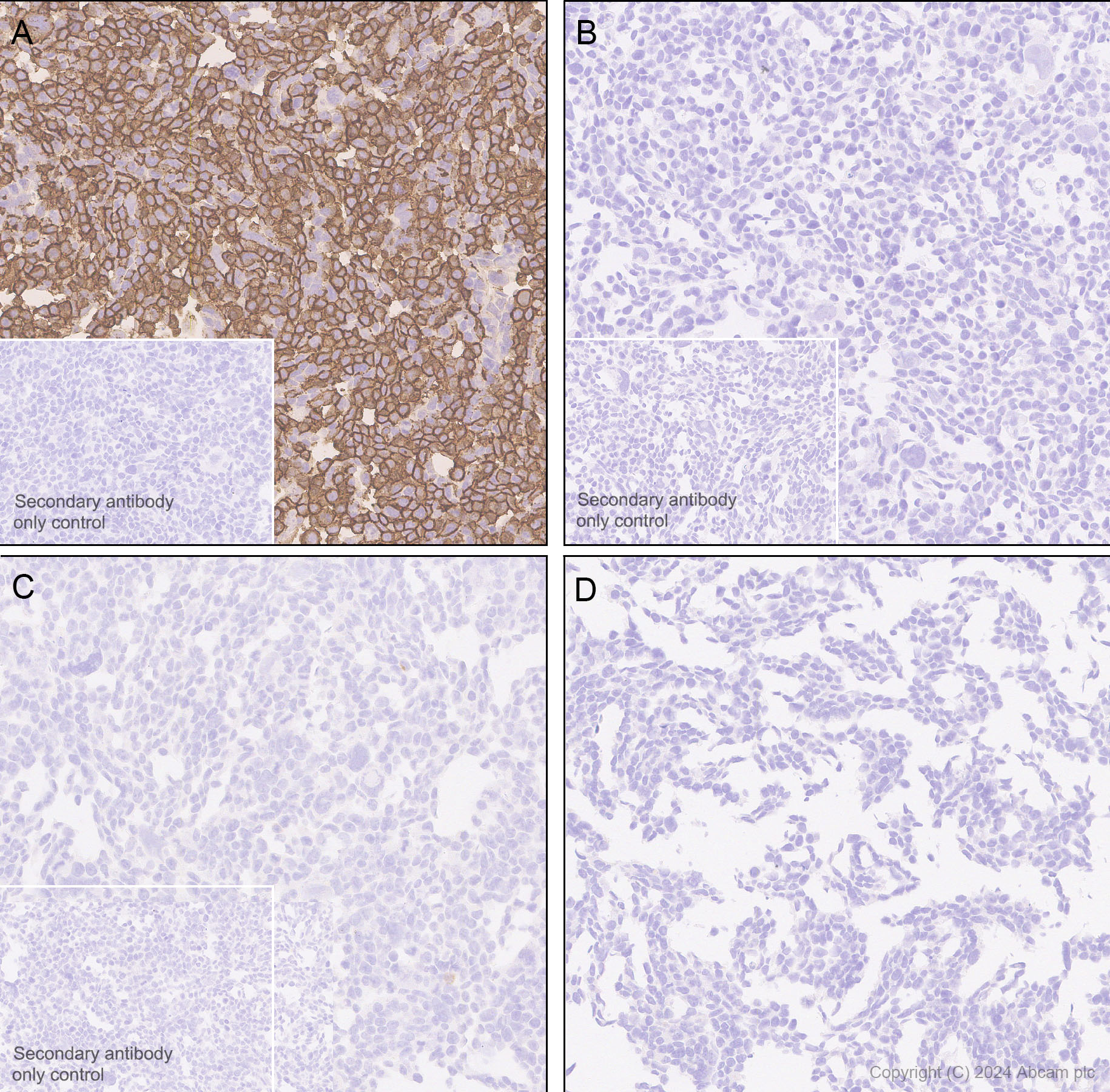 Immunohistochemistry (Formalin/PFA-fixed paraffin-embedded sections) - Anti-Neuroligin 2 antibody [RM2048] (AB317510), expandable thumbnail